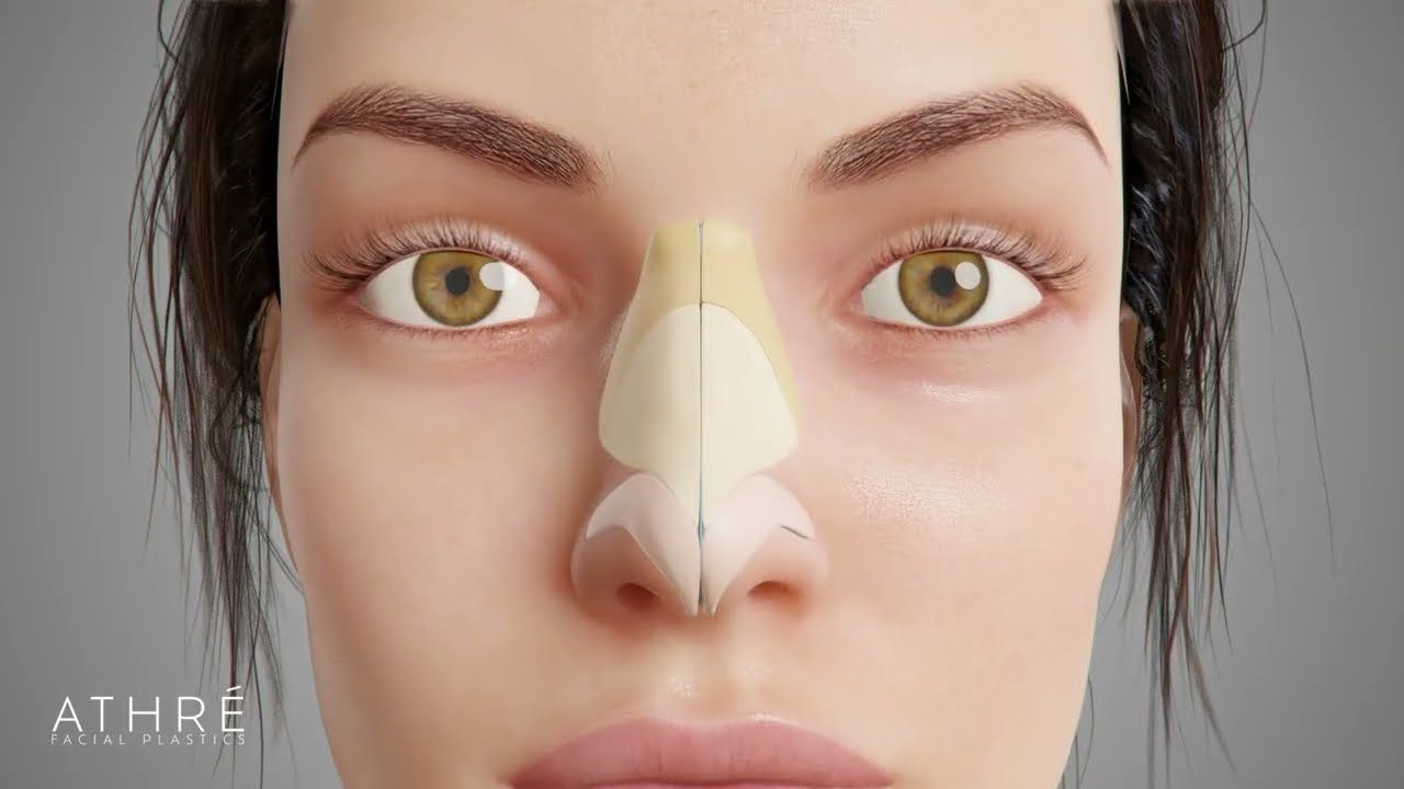 3D model of a woman's facial structure.