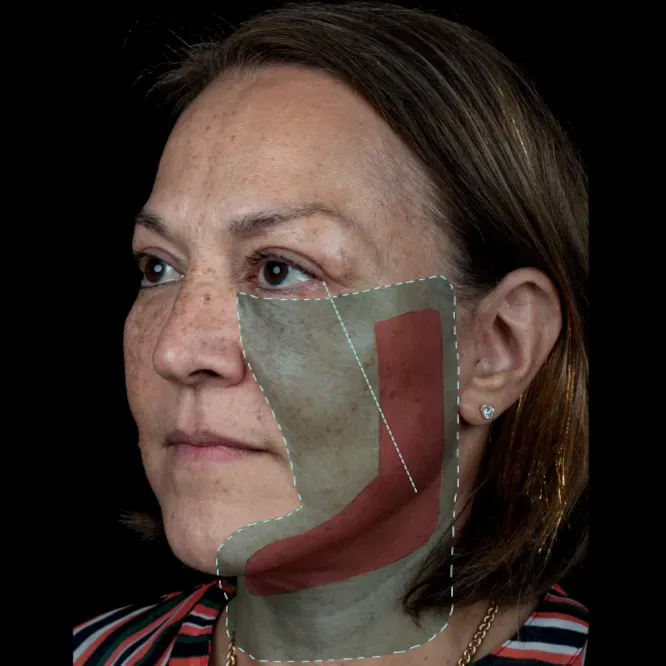 Facial anatomy illustration on a woman’s profile.