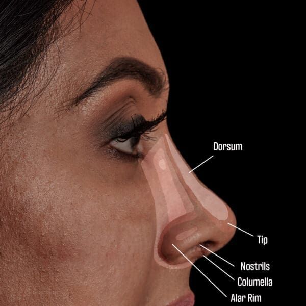 Nasal terminology profile