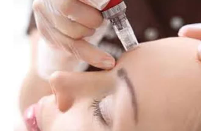woman receiving a skincare treatment on her forehead
