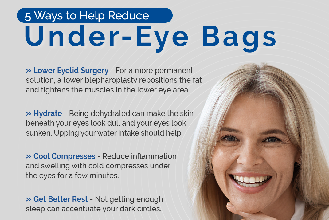 5 Ways to Help Reduce Under-Eye Bags thumb