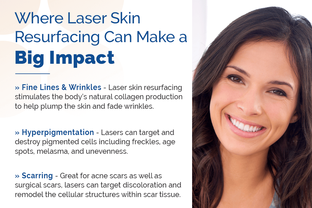 Where Laser Skin Resurfacing Can Make a Big Impact