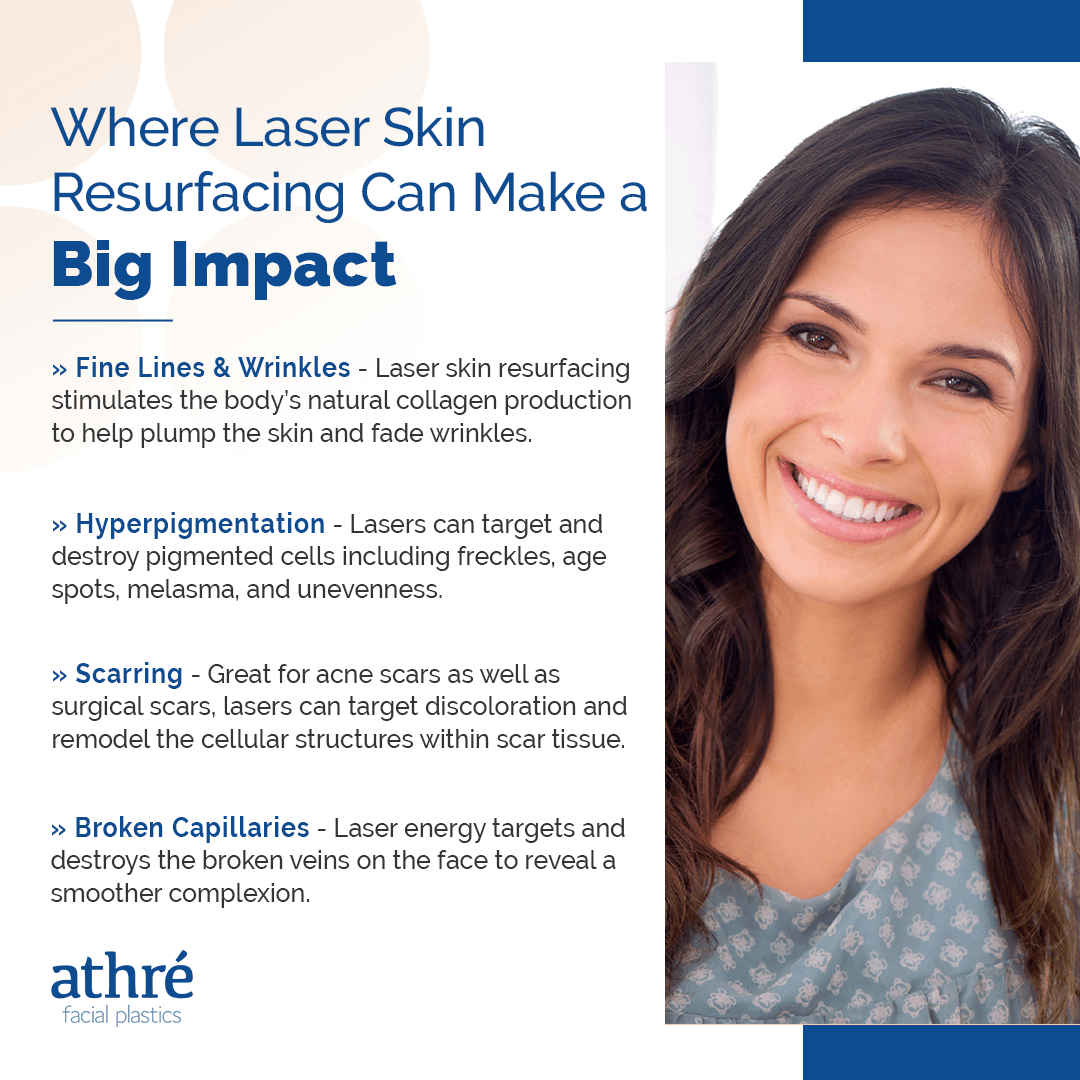 Where Laser Skin Resurfacing Can Make a Big Impact