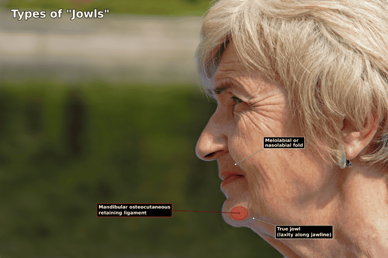 Types of Jowls Labeled