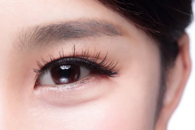 Picture of Asian upper eyelid with partial double eyelid crease.