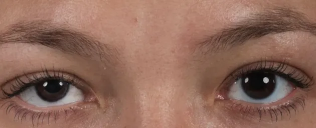 Close-up of a person's face, focusing on their brown eyes, eyebrows, and part of their upper nose and facial skin—ideal for showcasing results from Houston blepharoplasty.
