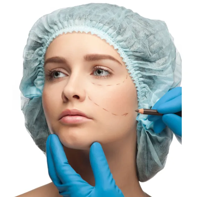 midface-lift-1