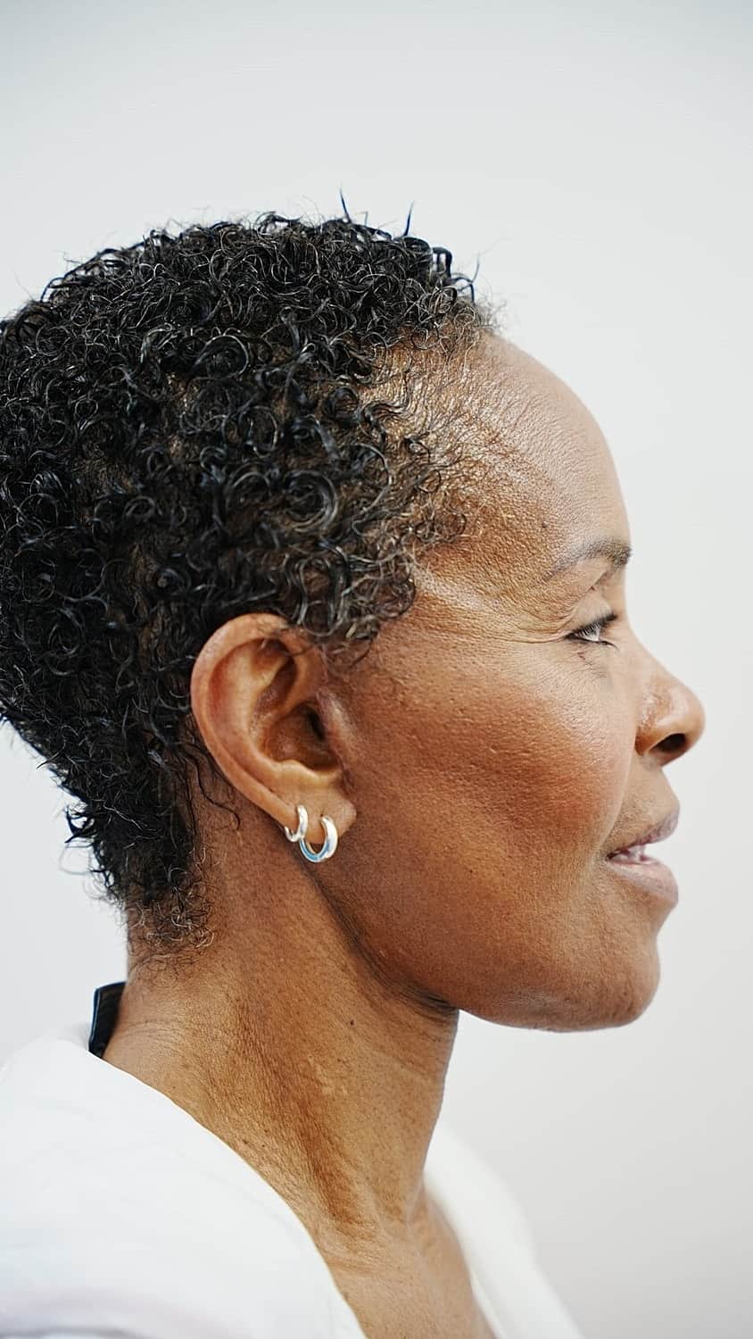 Vivian 1 month after revision facelift surgery, profile view